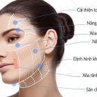 Căng da mặt bằng chỉ là gì? Các loại chỉ căng da an toàn nhất